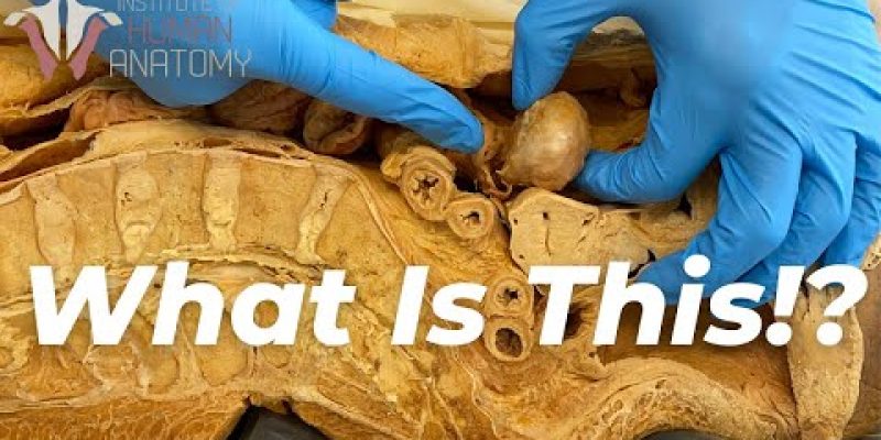 5 Craziest Things I’ve Found In Dead Bodies