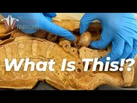 5 Craziest Things I’ve Found In Dead Bodies