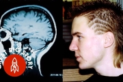 Meet the Accidental Genius