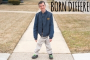 The Incredible Man With Legs Like Scissors