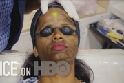 Why India’s Fair Skin Business Is Booming